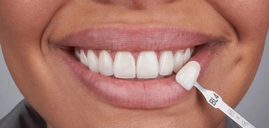 cosmetic dentistry in white rock, bc