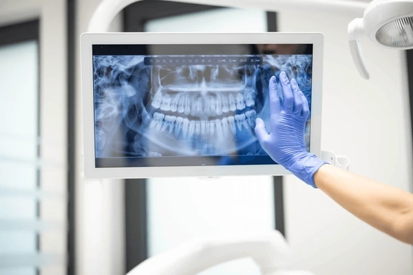 digital x rays near you