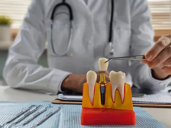 implant dentistry in white rock, bc