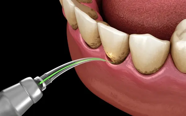 laser dentistry near you
