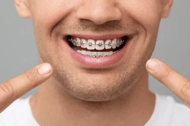 orthodontics in white rock, bc