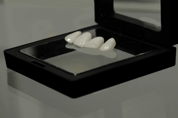porcelain veneers in white rock, bc